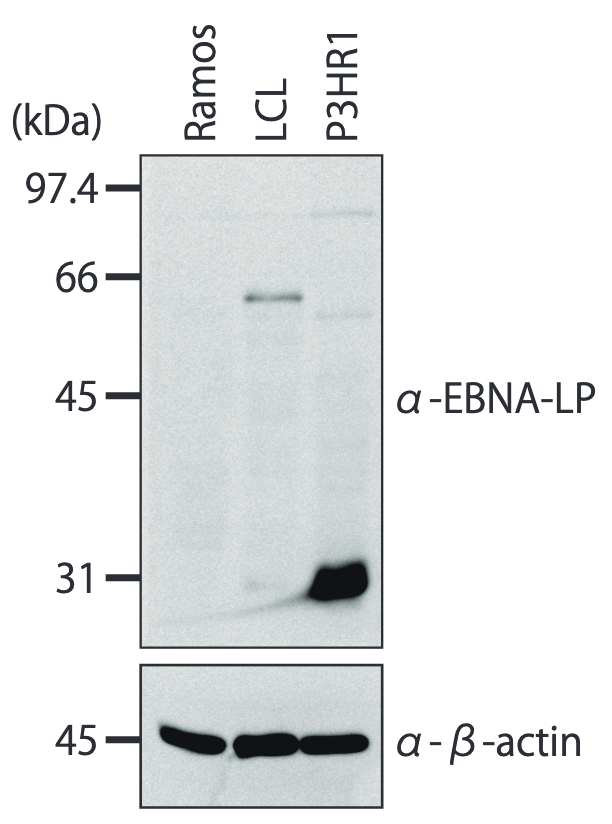 Anti Epstein-Barr Virus Nuclear Antigen Leader Protein (EBNA-LP) mAb (Clone: LP4D3)