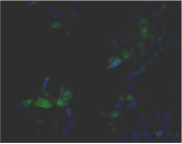 Anti Human Transmembrane Glycoprotein NMB (GPNMB) pAb (Rabbit, Purified Ig)
