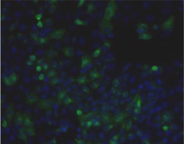 Anti Inter-Alpha-Trypsin Inhibitor Heavy Chain H4 (ITIH4) pAb (Sprague Dawley Rat, Antiserum)