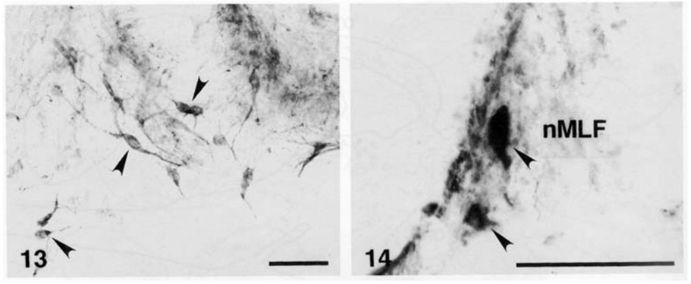Anti des-pyroGlu-Gonadotropin-Releasing Hormone II (GnRH II/LH-RH II) pAb (Rabbit, Antiserum)