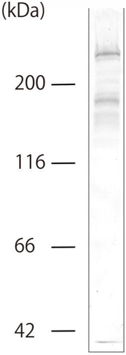 Anti Collagen Alpha-1(VII) Chain mAb (Clone BML39)