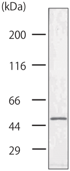 Anti Keratin, Type II Cytoskeletal 8 (Keratin-8) mAb (Clone RL273)