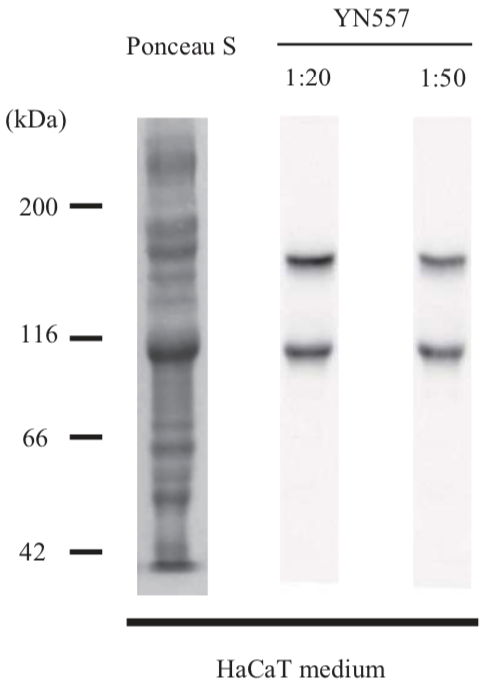 Anti Laminin Subunit Gamma-2 mAb (Clone YN557)