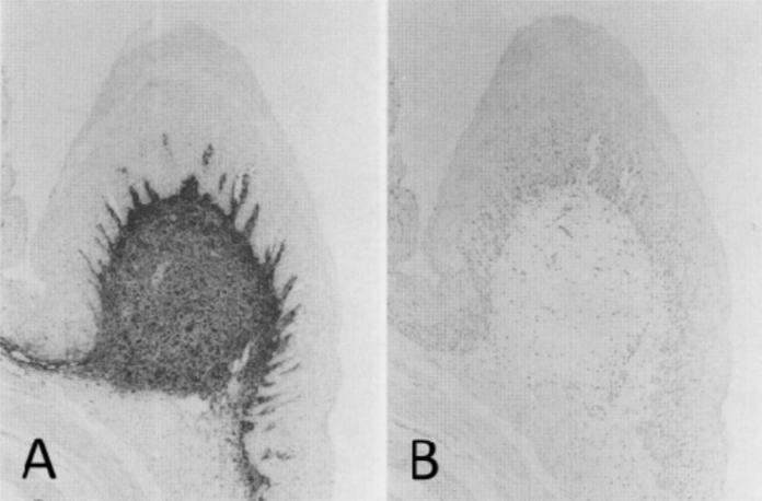 Anti Chondroitin Sulfate A mAb (Clone 2H6)