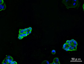 Anti EpCAM