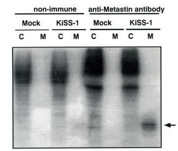 Anti Metastasis-Suppressor KiSS-1 (Metastin/Kisspeptin-1) pAb (Rabbit, Antiserum)