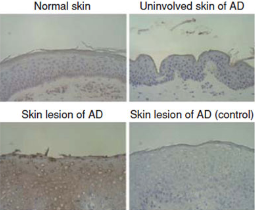 Anti Serpin B3 (SCCA1/T4-A) and Serpin B4 (SCCA2/Leupin) pAb (Rabbit, Antiserum)