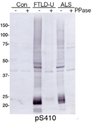 Anti TAR DNA-Binding Protein 43 (TDP-43), phospho Ser410 pAb (Rabbit, Antiserum)