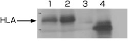 Anti HLA class I-A,B,C mAb (Clone EMR8-5)