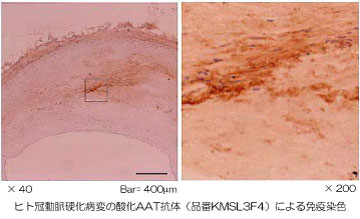 Anti Native ALPHA1 Antitrypsin mAb (Clone S3-1)