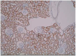 Anti Aldo-Keto Reductase Family 7 Member A3 (AKR7A3) central region mAb (Clone 2B8)