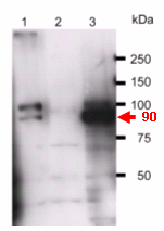 Anti TRPV 4 pAb