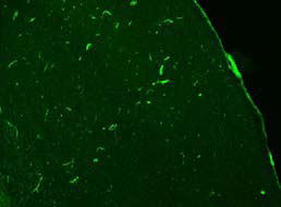 Anti Thromboxane A2 Receptor (TBXA2R) N-terminal region pAb (Rabbit, Affinity Purified)
