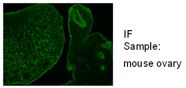 Anti Empty Spiracles Homeobox 2 (Emx2) pAb (Rabbit, Purified Ig)