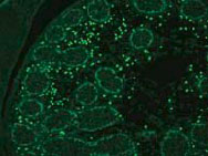 Anti Nuclear Receptor Subfamily 5 Group A Member 1 (NR5A1) mAb (Clone 1B1F10)