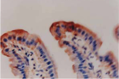 Anti Cation Chloride Cotransporter 9 (CCC9) pAb