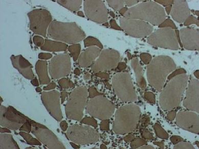 Anti Chemokine-like Factor 1/ CKLF1 pAb