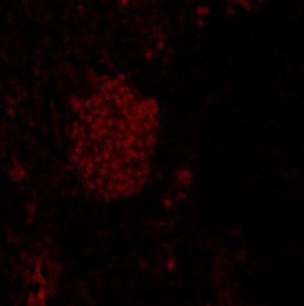 Anti Motor Neuron And Pancreas Homeobox 1 (HLXB9/MNX1) pAb (Rabbit, Affinity Purified)