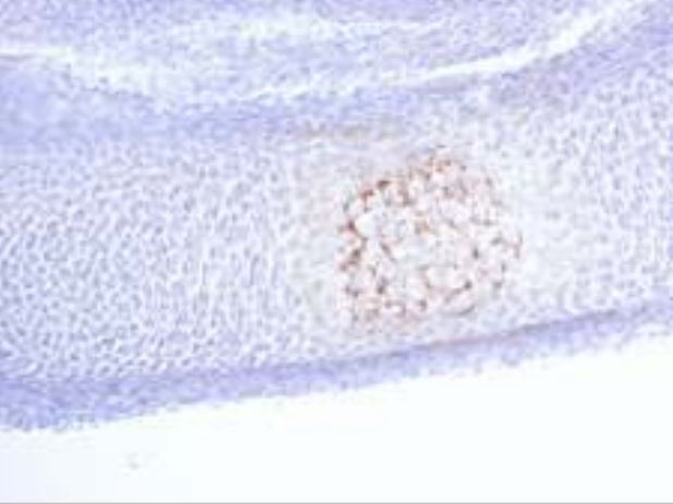 Anti Matrix Gla Protein / MGP pAb
