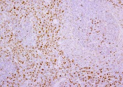 Anti Macrophage / Dendritic Cells mAb (Clone RM-4)
