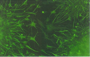 Anti Prion Protein B pAb
