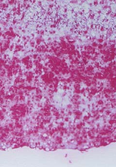 Anti Hexanoyl-Lys (HEL) mAb (Clone 5F12)