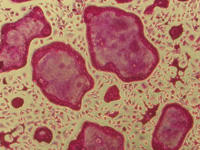 TRAP Staining Kit