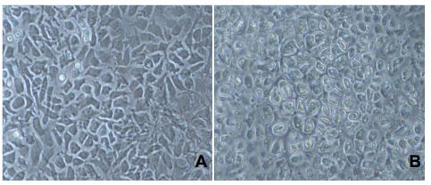 Chondrocytes (rabbit)