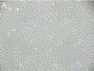 Endothelial Cells (porcine)