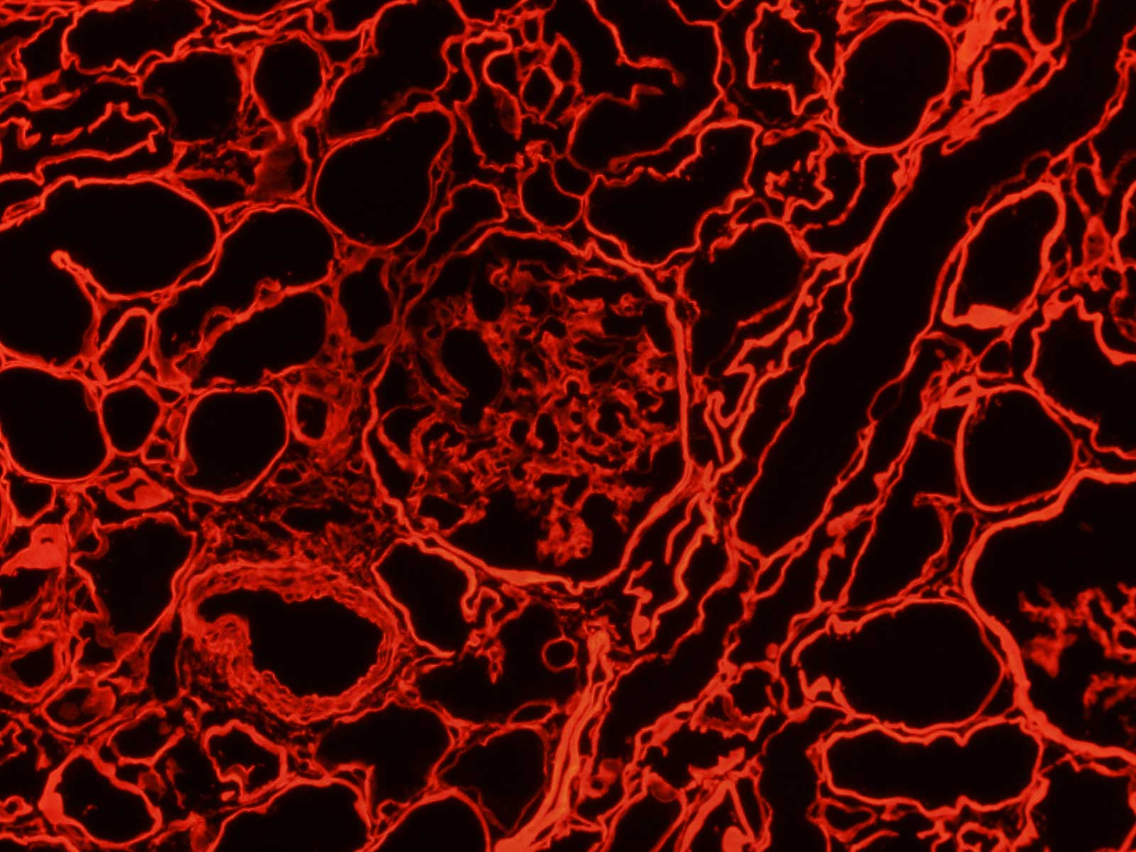 Anti Collagen 4 (ALPHA)2(IV) mAb (Clone H25, Texas Red)