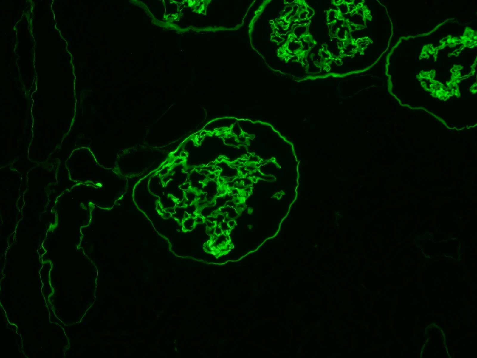 Anti Collagen 4 (ALPHA)5(IV) mAb (Clone H53, Fluorescein Labeled)