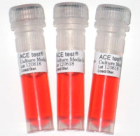 ACE test (Medium for B. atrophaeus)