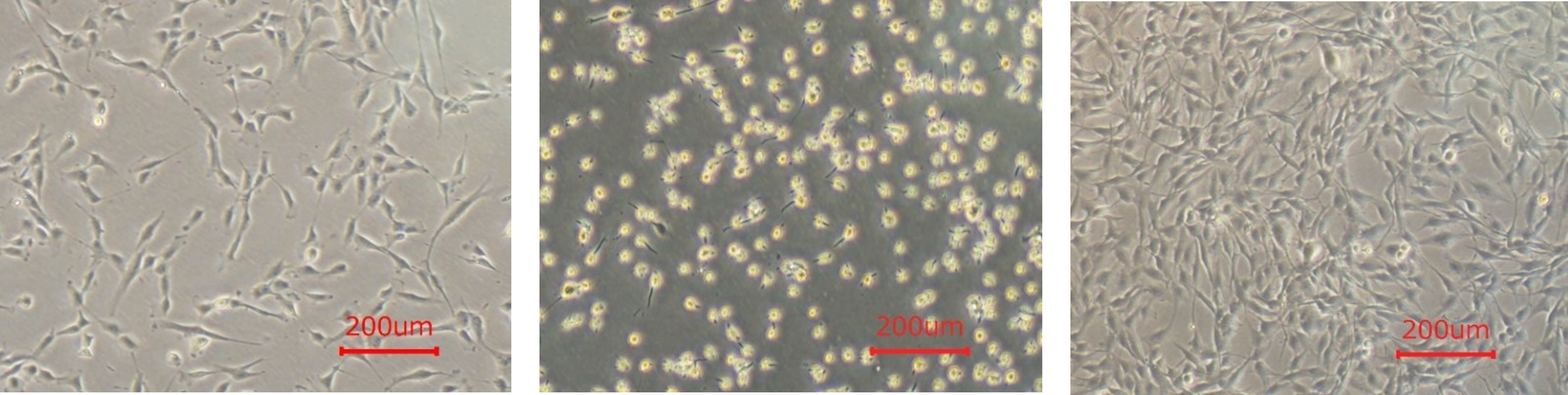 KBM Trypsin AOF