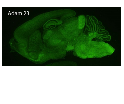 ADAM23 polyclonal antibody (Rb)