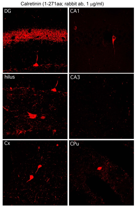 Calretinin polyclonal antibody (Rb)