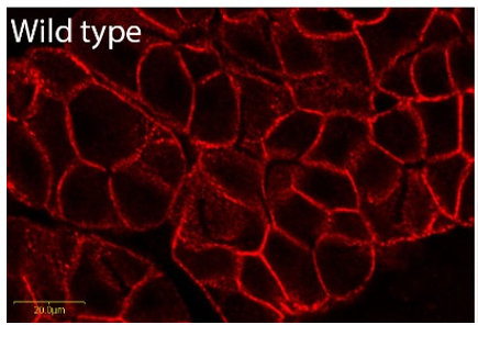 CCKA (CCK1) receptor polyclonal antibody (Rb)