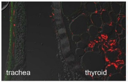 CGRP polyclonal antibody (Rb)