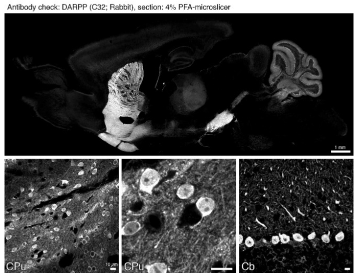 DARPP32 polyclonal antibody (Rb)