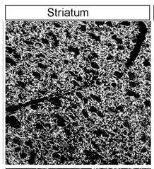 DAT polyclonal antibody (Go)