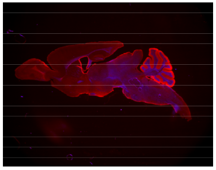 DBI polyclonal antibody (Rb)
