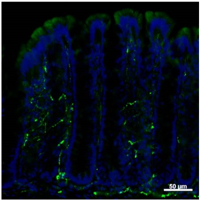 FFA3 (GPR41) polyclonal antibody (Rb)