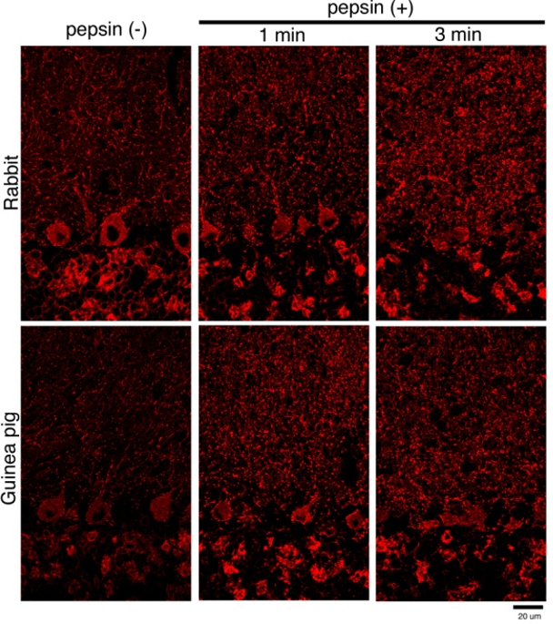 GABAA receptor-a1 polyclonal antibody (GP)