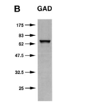 GAD67/65 polyclonal antibody (Rb)