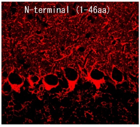 GAT-1 polyclonal antibody (Rb)