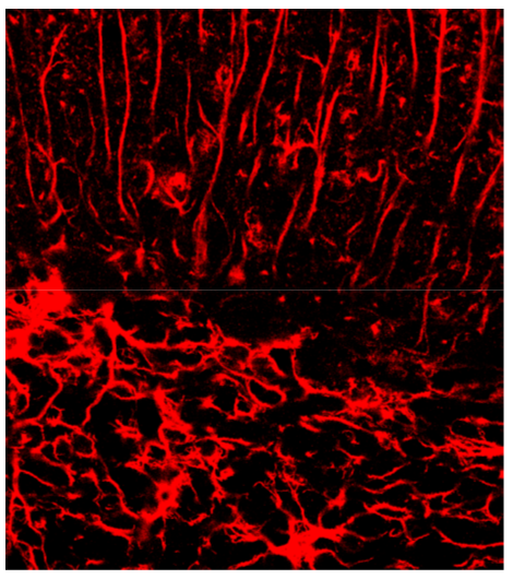 GFAP polyclonal antibody (Go)