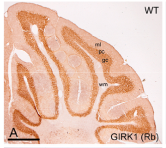 GIRK1 polyclonal antibody (GP)