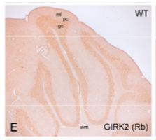 GIRK2 polyclonal antibody (GP)