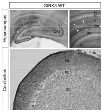 GIRK3 polyclonal antibody (Rb)