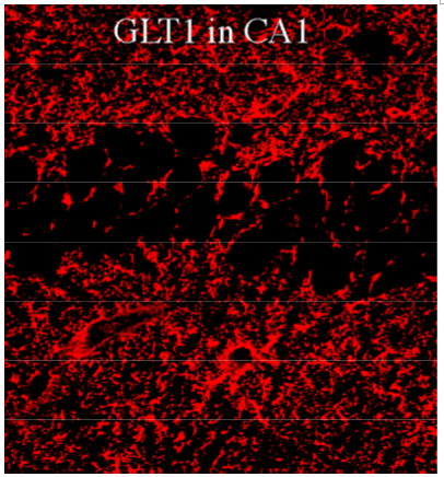 GLT1 polyclonal antibody (GP)