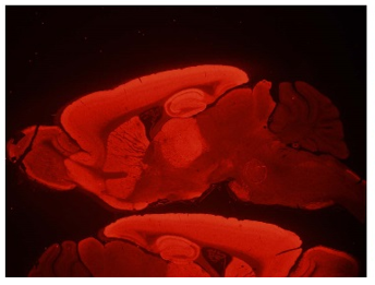 GluN2B,C-term (NR2B) polyclonal antibody (Rb)